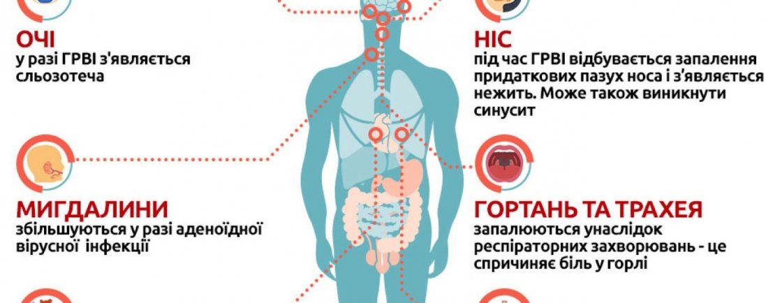 В Україні від грипу помер чоловік