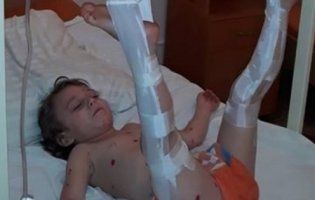 У київській лікарні на малюка впали металеві двері (фото)