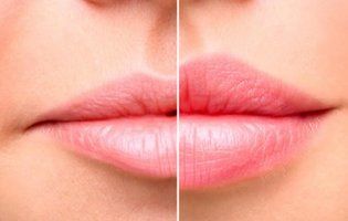 Як збільшити губи та зробити їх пухлими?