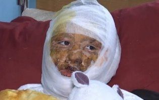 У Чернівцях батько підпалив 16-річну доньку (фото)