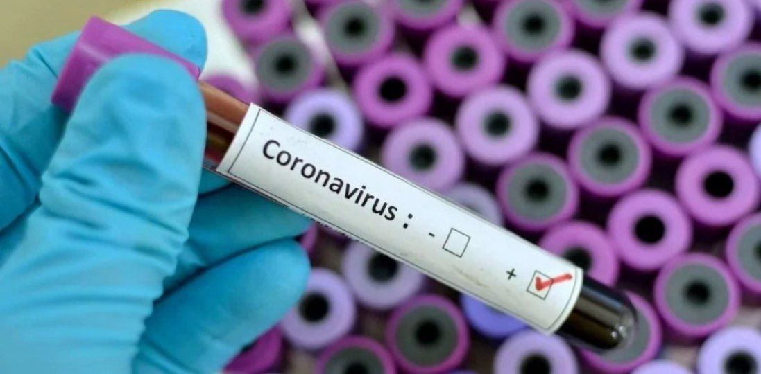 Кількість хворих на коронавірус перевищила 75 тисяч