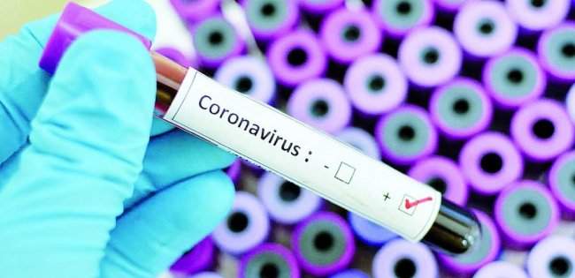 В інфікованого коронавірусом жителя Чернівців підозрюють пневмонію