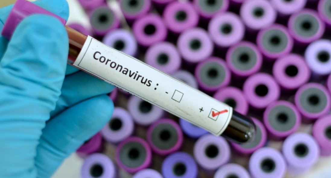 На Тернопільщині у жінки підтвердили коронавірус: зафіксували понад 60 підозр