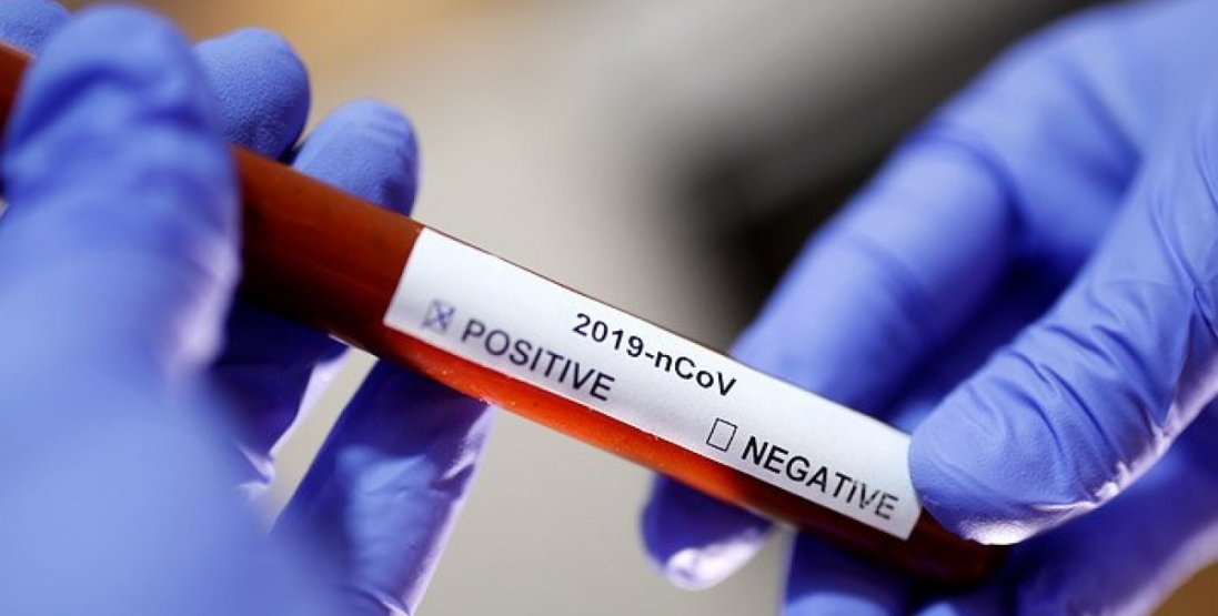 В Україні – п’ять підтверджених випадків коронавірусу