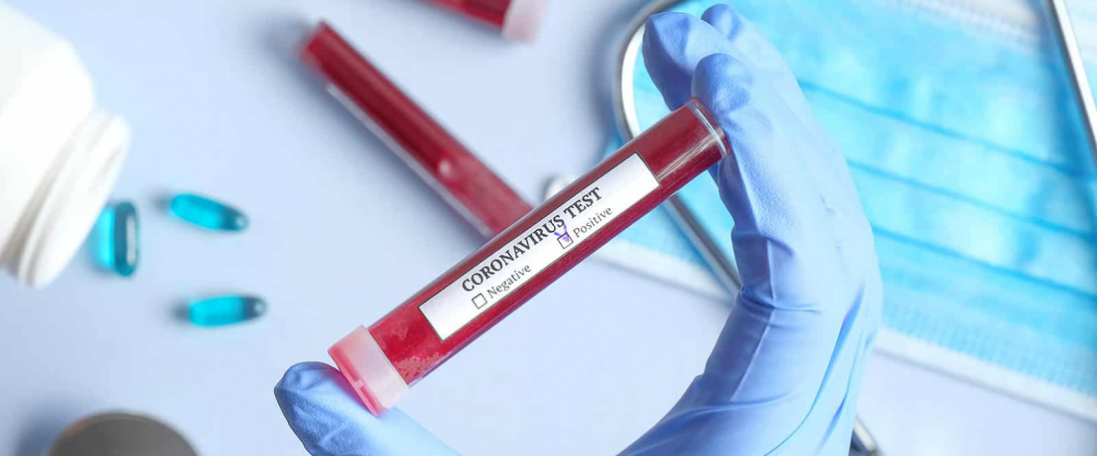 З Китаю в Україну доставлять 10 мільйонів тестів на коронавірус. Коли?