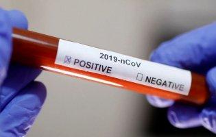 За добу в Італії від коронавірусу померли 743 людини