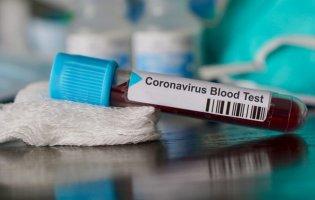 Офіційно: в Україні – п’ять летальних випадків від коронавірусу