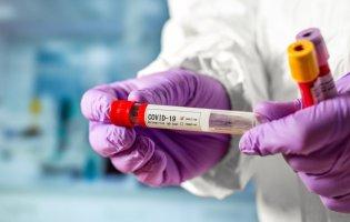 В Україні виготовлятимуть тест-системи для діагностики коронавірусу