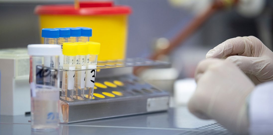 На Чернігівщині – перший підтверджений випадок коронавірусу