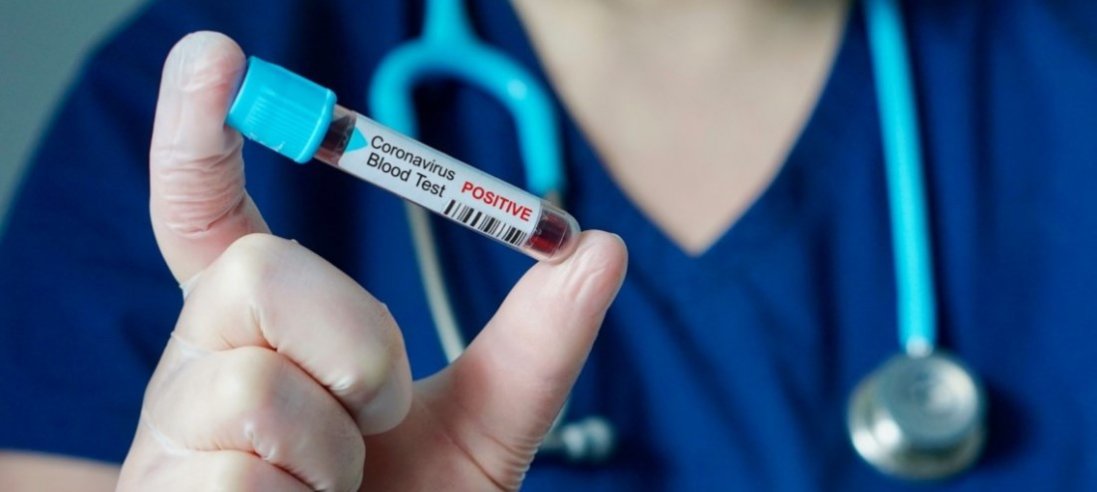 Підозра на коронавірус: на Херсонщині помер 45-річний чоловік