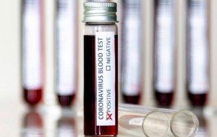 В Івано-Франківську експрес-тести засвідчили коронавірус у 57 пацієнтів із пневмонією