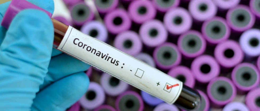 У Бельгії від коронавірусу померла 12-річна дитина