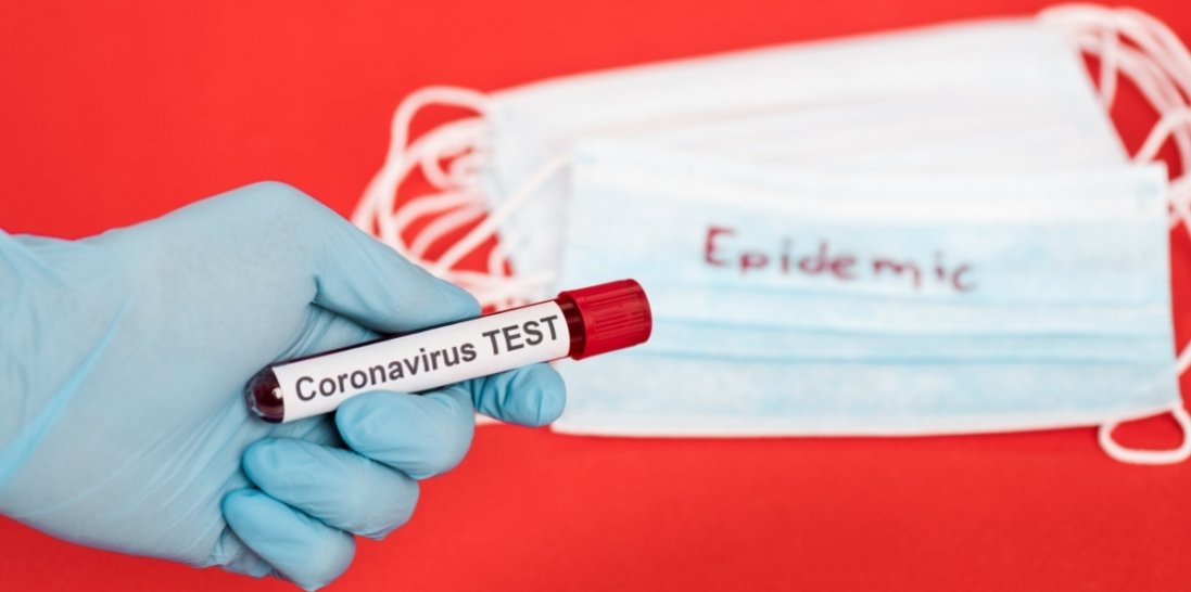 Коронавірус в Україні: чому не проводять масового тестування