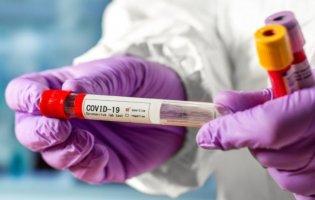 В Україні 1462 випадки COVID-19, з них 45 летальних