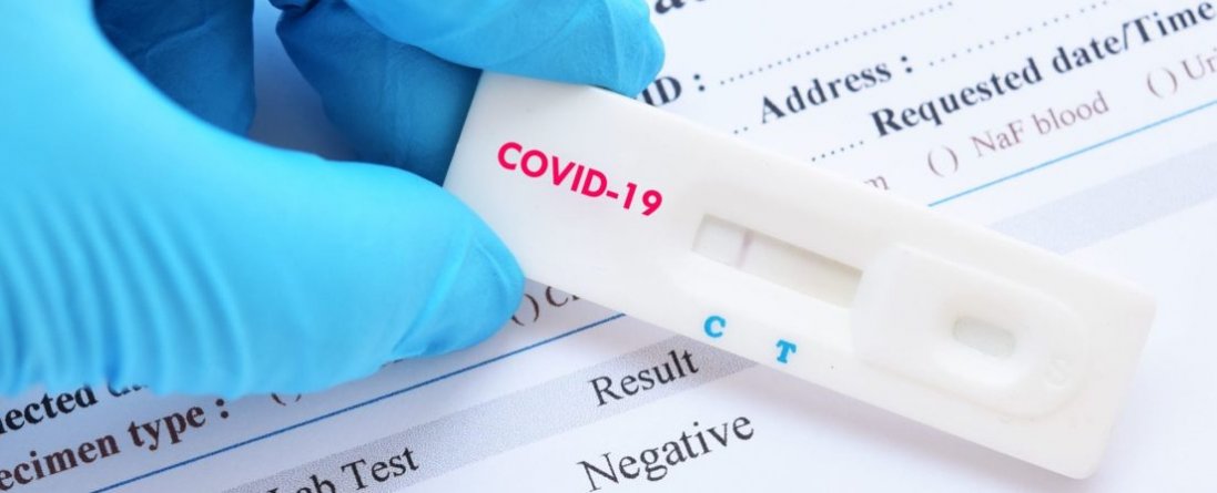 В Україні в аптеках можна буде придбати тести на COVID-19, – МОЗ