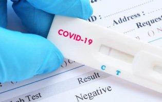 В Україні в аптеках можна буде придбати тести на COVID-19, – МОЗ
