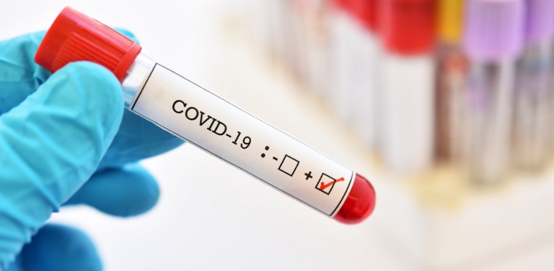 В Україні сім областей приховують інформацію про хворих на коронавірус