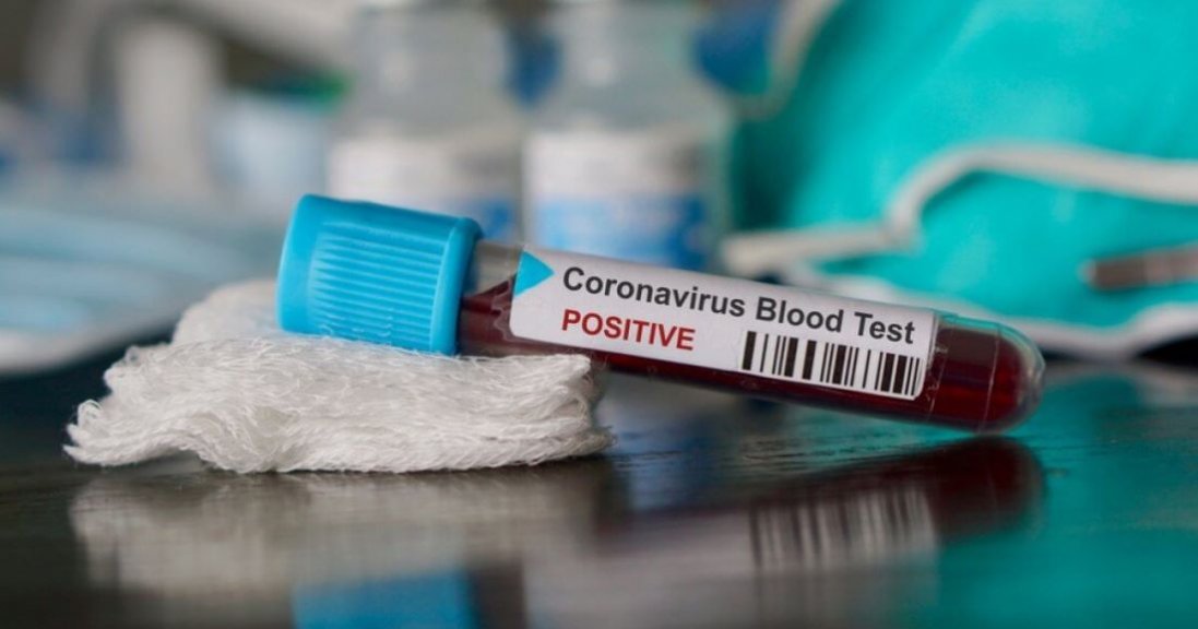 У чотирьох жителів Рівненщини повторно виявили коронавірус