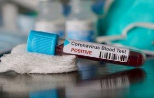 У чотирьох жителів Рівненщини повторно виявили коронавірус