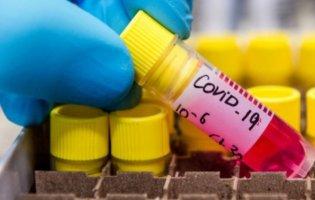 На Львівщині 58-річна жінка приховала COVID-19 і заразила медиків