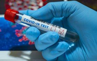 На Дніпропетровщині підтвердили понад 40 нових випадків коронавірусу