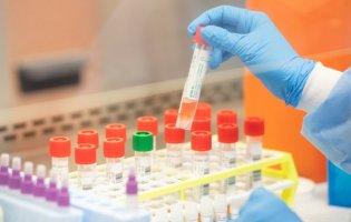 В Україні безкоштовні тести на COVID-19 робитимуть не всім: хто має право