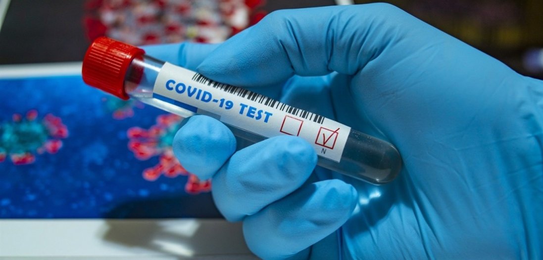 Який прогноз поширення коронавірусу на наступні тижні дали у НАН