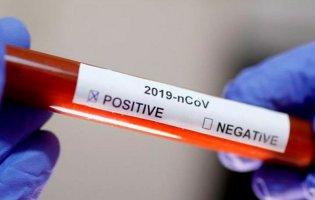 ІФА-тест на COVID-19: за скільки його роблять у Луцьку