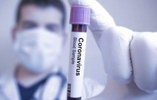 У МОЗ назвали орієнтовну вартість вакцини від COVID-19