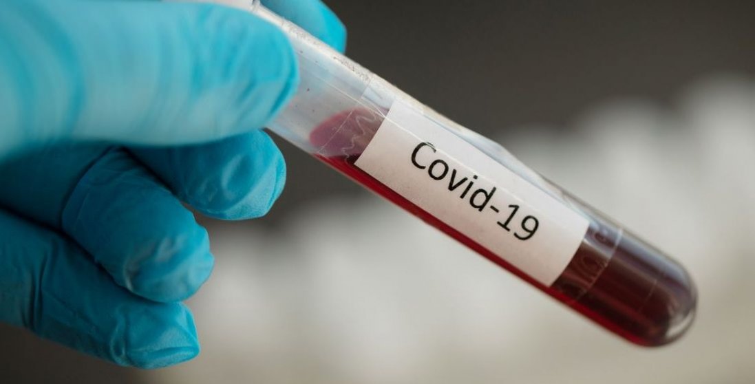 На Волині виявили 63 нових випадків COVID-19. Де найбільше?  (22 серпня)