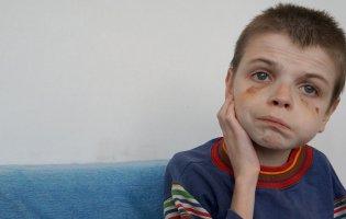 В інтернаті Києва знущаються над дітьми-аутистами: моторошне відео