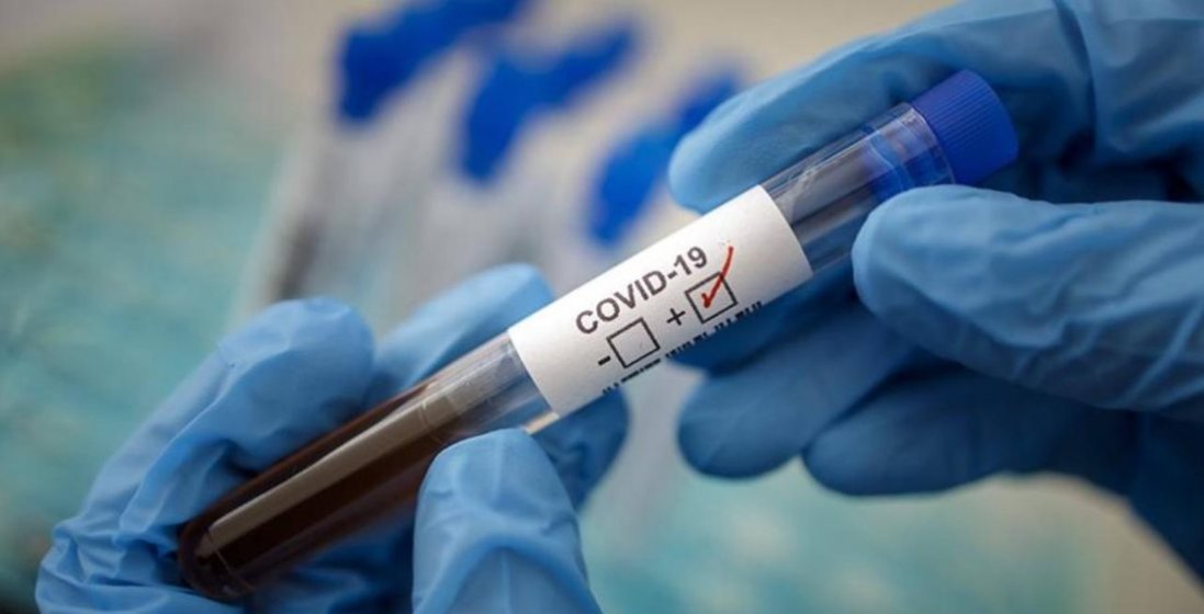 В Україні – 3 627 нових випадків коронавірусу, на Волині – 136 (29 вересня)