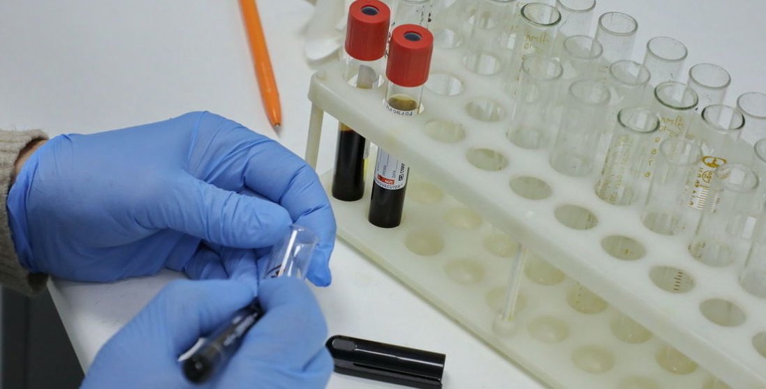 Знову антирекорд: в Україні за останню добу – 4633 випадки коронавірусу (2 жовтня)