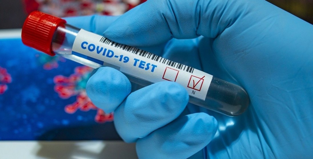 У Чернівецькій області 20 осіб повторно заразилися коронавірусом
