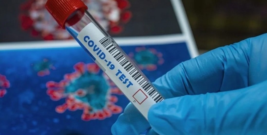В Україні –  5 133 нових випадки коронавірусу, на Волині – 164 (13 жовтня)