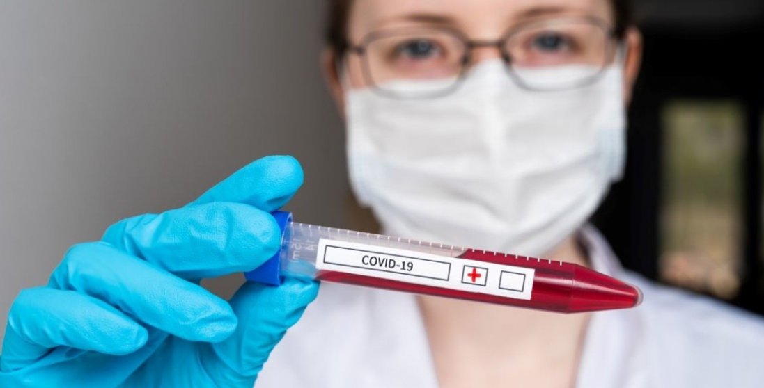 В Україні – 5 469 випадків коронавірусу, на Волині – 178 (20 жовтня)
