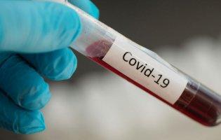 В Україні вперше 165 смертей від коронавірусу