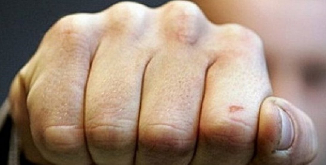 У Луцьку жорстоко побили 20-річного хлопця: що відомо