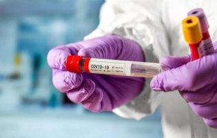 Як жінкам зменшити ризик захворіти на коронавірус: висновки вчених
