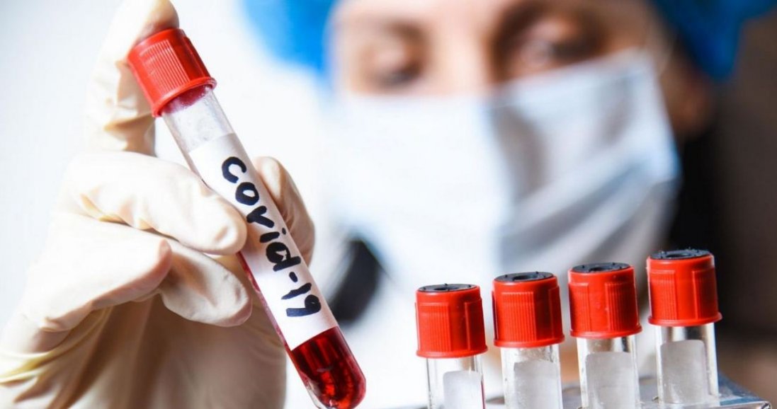 Лікарі назвали нову небезпечну ознаку коронавірусу