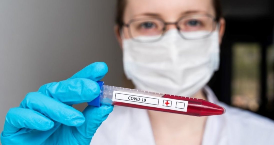 Вчені: антитіла можуть не врятувати від коронавірусу