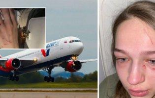 «Роздряпали обличчя і відгризли ніготь», – деталі побиття українки в літаку