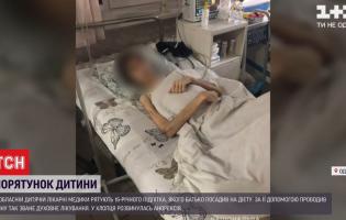 Зріст 180 см, а вага - 30 кг: в Одесі лікарі рятують хлопця, якого батько лікував від нечистого