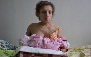 У Червонограді померла найнижча в Україні мама: жінка мала зріст 96 см