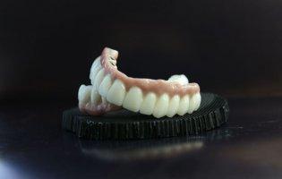 Знімні та незнімні зубні протези та їх особливості