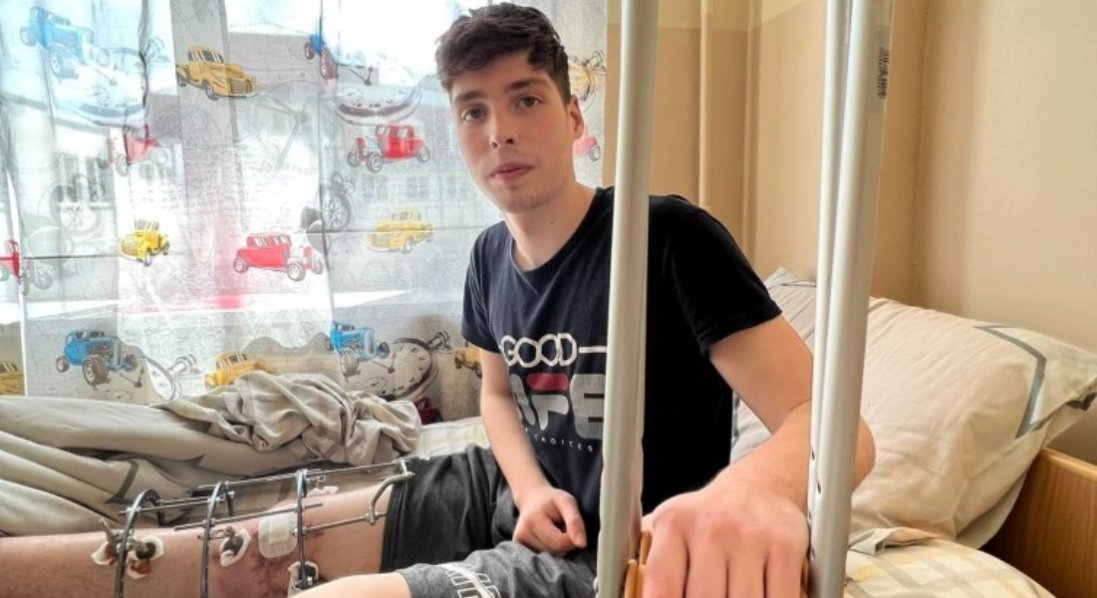 Возив їжу захисникам: 17-річному волонтеру з Сєвєродонецька врятували ногу
