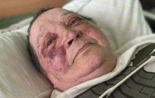 У Херсоні росіяни зламали хребет 70-річній волонтерці