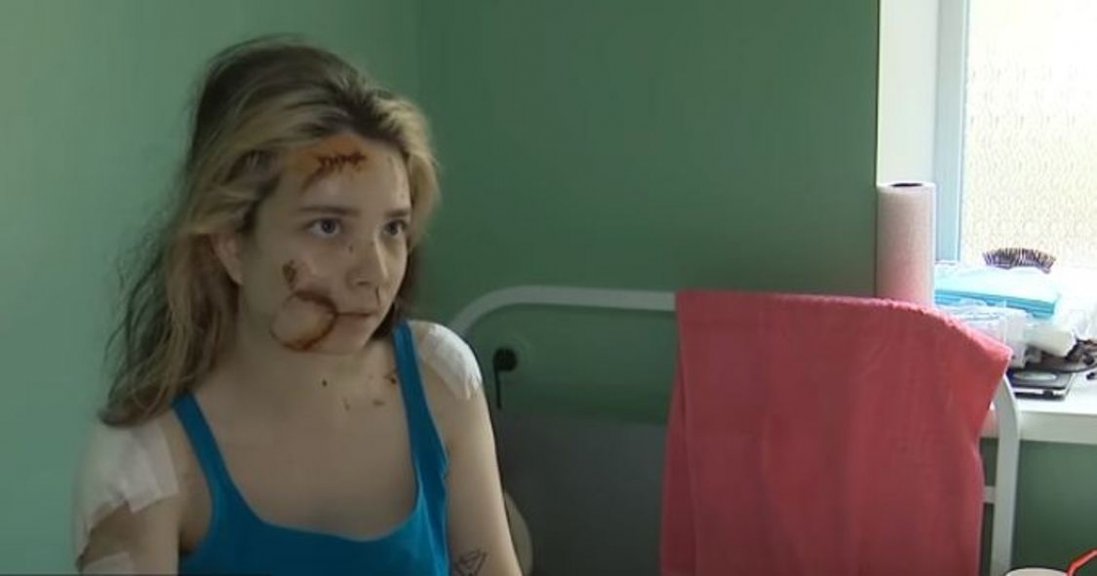 «Мене знайшли під завалами»: розповідь 19-річної Олени Безус,  яка вижила при ударі по ТЦ у Кременчузі