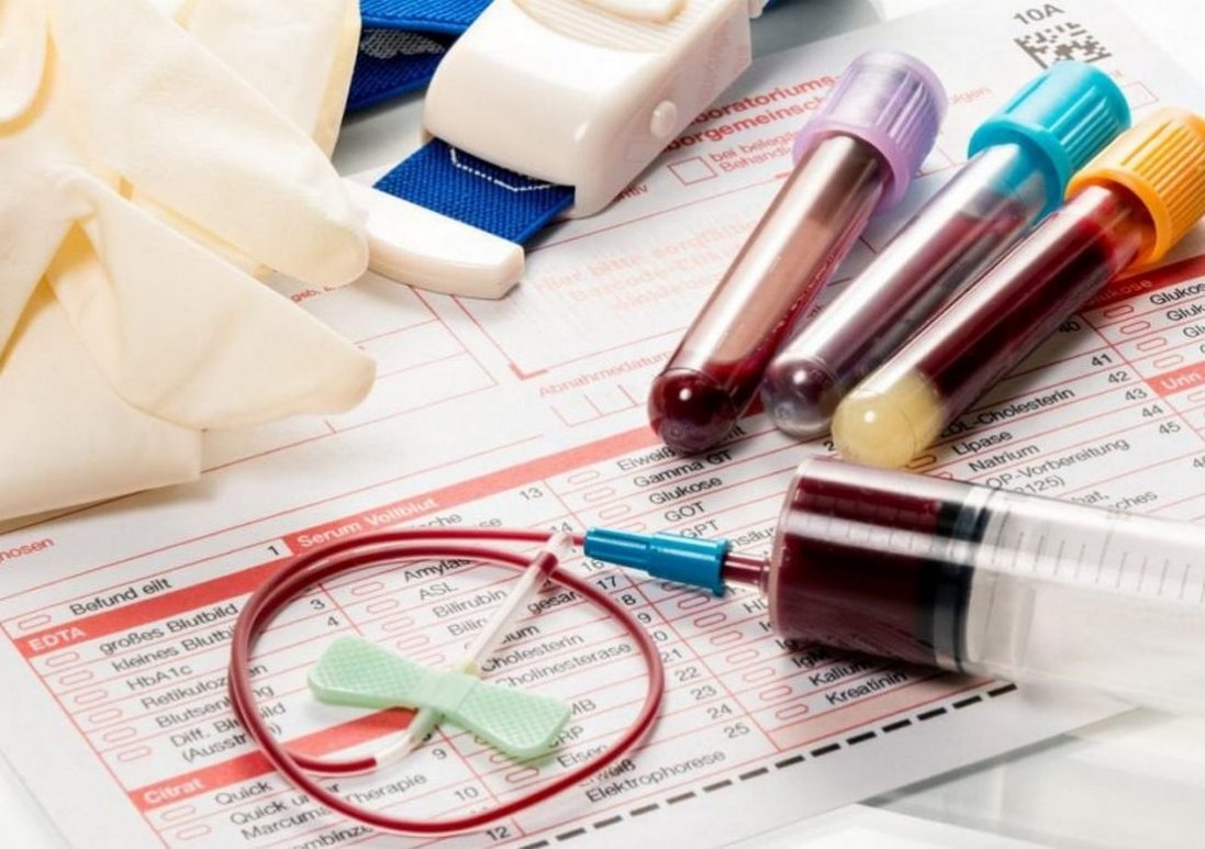 Сфера використання та особливості призначення загального аналізу крові