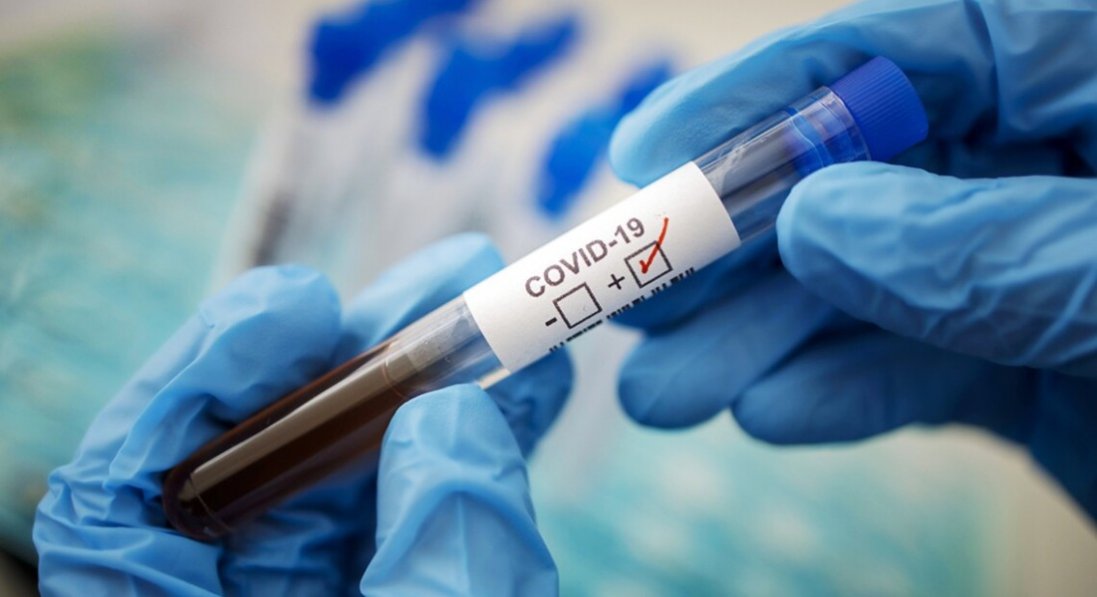 Коли в Україні буде пік захворюваності на коронавірус